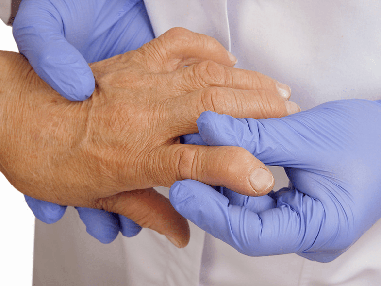 un médecin examine la main pour déceler des douleurs dans les articulations des doigts